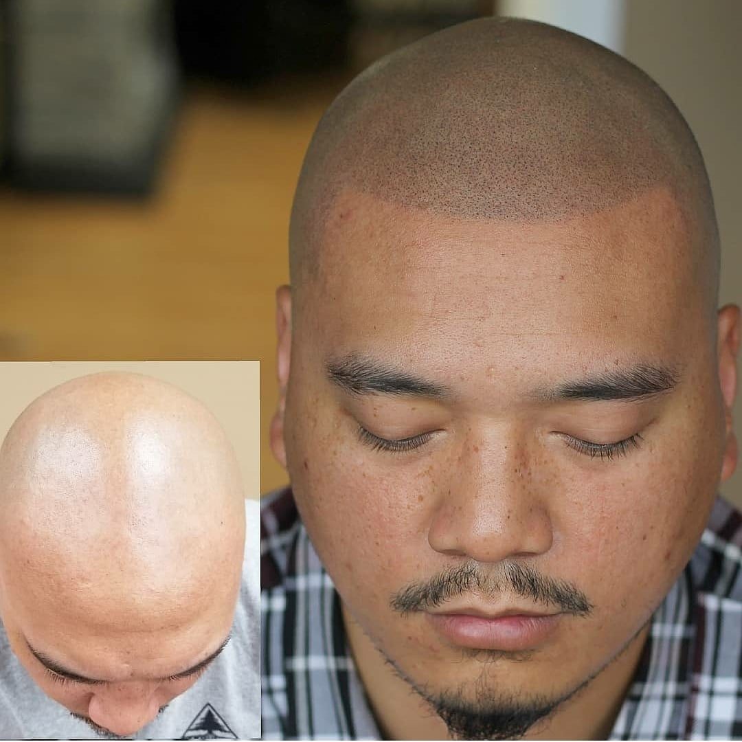 Before and after SMP transformation